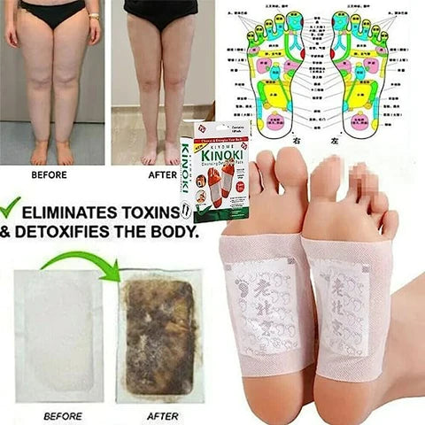 🔴LA MEJOR PROMOCIÓN DE CHILE PACK 60 PARCHES 6 CAJAS POR EL PRECIO DE 1 DESINTOXICANTES Y REHABILITANTES DE CUERPO