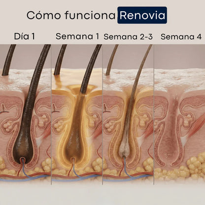 2x1 Cyperus Rotundus Renovia™ | Detén el crecimiento del vello no deseado de forma natural