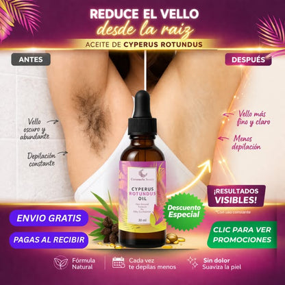 2x1 Cyperus Rotundus Renovia™ | Detén el crecimiento del vello no deseado de forma natural
