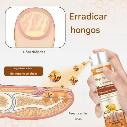 🌿  TERBFIN Spray Antihongos – Protección y cuidado para tus uñas