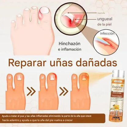 🌿  TERBFIN Spray Antihongos – Protección y cuidado para tus uñas