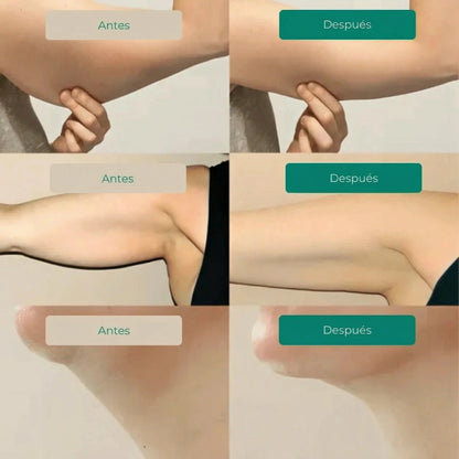 2x1 Merry  Linfático 🌿 💧Drena Naturalmente la Hinchazón del Rostro, Abdomen y Piernas