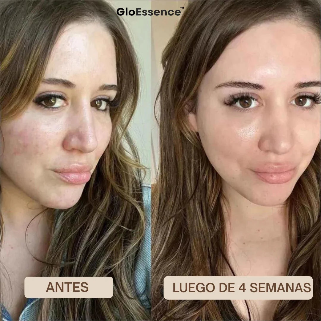 Mascara Facial Con Acido Hialuronico