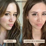 Mascara Facial Con Acido Hialuronico