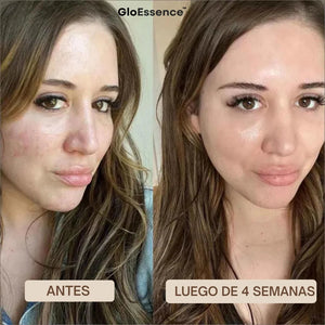 Mascara Facial Con Acido Hialuronico
